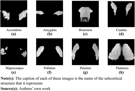 Eight brain structures on black backgrounds.