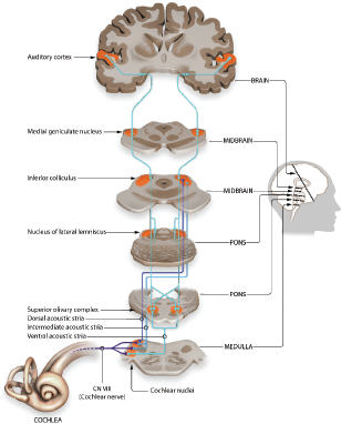 A diagram illustrates the Auditory Pathway from the Cochlea up to the Auditory cortex in the Brain. Starting at the bottom, sound information travels from the Cochlea via the C N V I I I (Cochlear nerve) to the Cochlear nuclei in the Medulla.