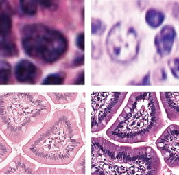 A set of four micrographs.