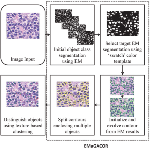 A flow chart illustrating the EMaGACOR segmentation method.