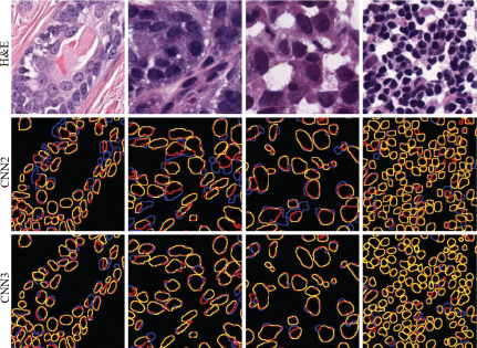 A four column grid of images. The top row shows four different H & E stained histology images of cells. The middle and bottom rows show segmentation results from C N N two and C N N three, respectively, with cell boundaries outlined in yellow, red, and blue over a black background.