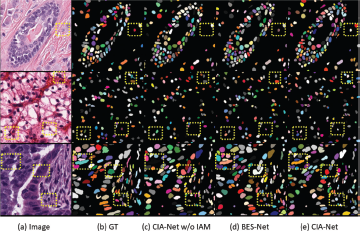 A two-part image showing histology micrographs with marked cells and a line graph comparing segmentation and clustering metrics versus pixel shift.