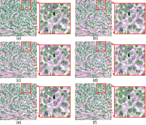 A three-row grid of images showing three different histology Input Images, their Ground Truth open parenthesis G T close parenthesis segmentation, and the results of three network models (C I A dash N e t w slash o I A M, B E S dash N e t, C I A dash N e t).