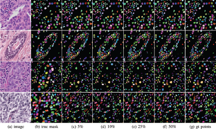 A grid comparing true mask segmentation of four histology images to results using 5%, 10%, 25%, and 50% partial supervision, and gt points.