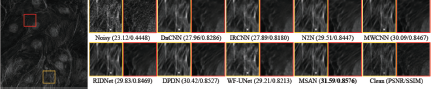 A figure showing an image of cells and cropped comparison patches for various noise reduction methods, with P S N R and S S I M values listed below.