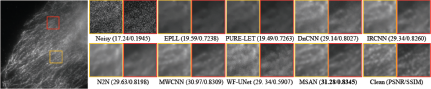 A figure showing an image with red and yellow boxes and cropped comparison patches for various noise reduction methods, with P S N R and S S I M values listed below.