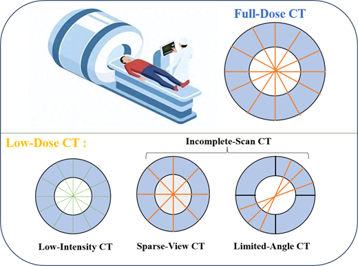 Comparison of C T scanning types showing full dose, low intensity, sparse view, and limited angle configurations.