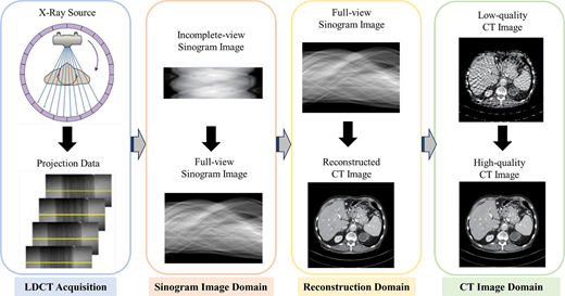 A workflow of L D C T acquisition and reconstruction showing sinogram completion and improvement from low quality to high quality C T image.