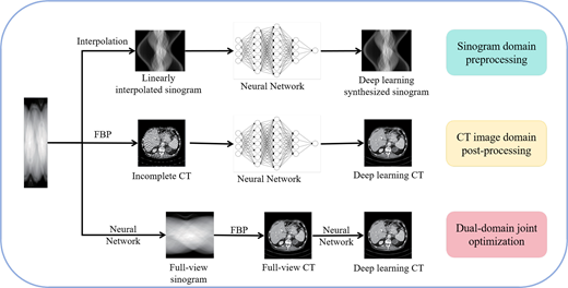 Three deep learning C T workflows showing sinogram preprocessing, C T image post-processing, and dual domain joint optimisation.