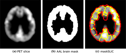 Three panels present a P E T brain slice, an A A L brain mask, and the masked slice divided into outlined regions.