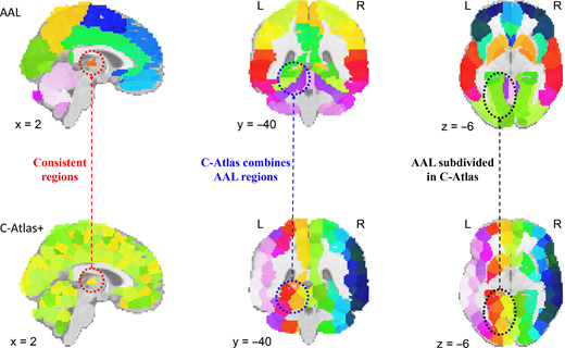 Six brain views compare A A L and C Atlas plus, highlighting consistent regions, combined A A L regions and subdivisions within C Atlas.