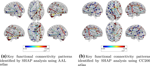 A key functional connectivity pattern identified by S H A P analysis using A A L and C C 200 atlases across multiple brain views.