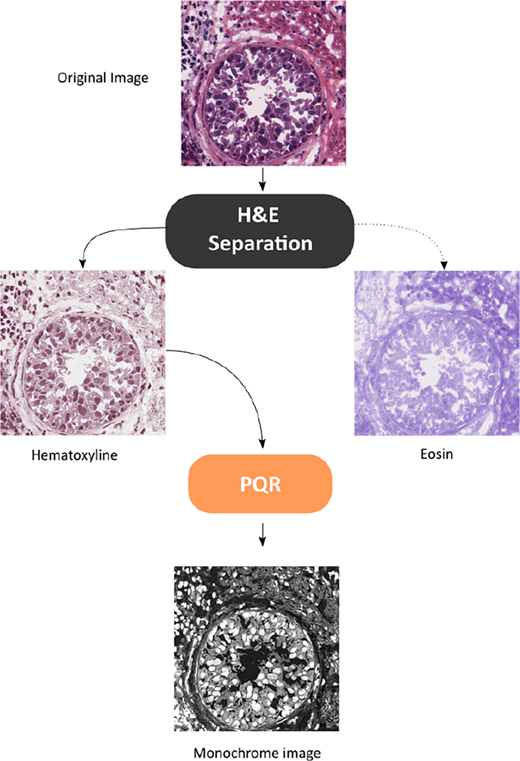 A processing diagram shows an original histology image separated into hematoxylin and eosin components, then transformed into a monochrome image using P Q R.