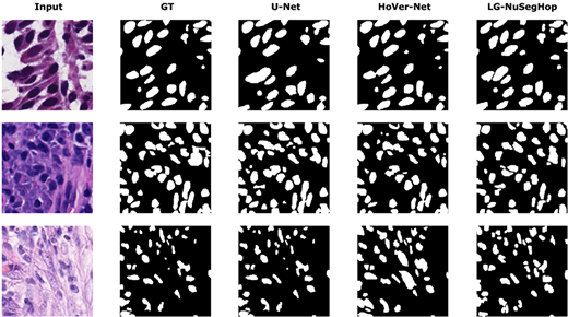 A grid compares input histology images with ground truth and three nuclei segmentation outputs from U Net, HoVer Net, and L G N u S e g H o p.