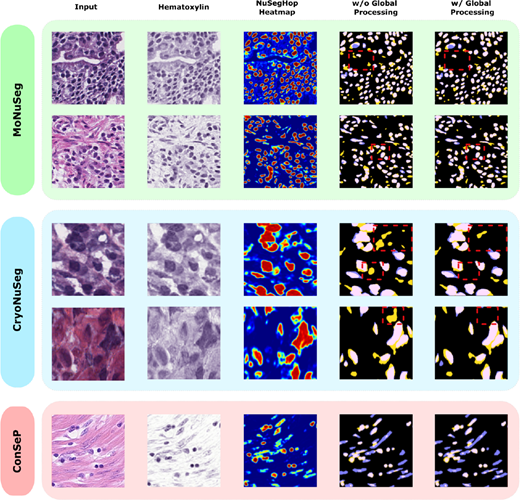 A multi-row grid compares input images, hematoxylin images, N u S e g H o p heatmaps, and nuclei segmentation results with and without global processing.