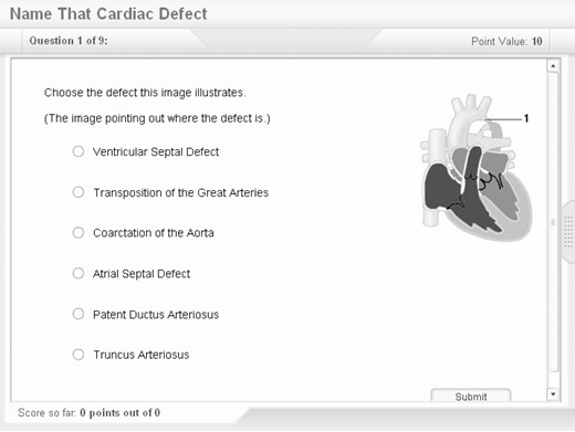 Quiz shows a picture of a heart defect and asks the user to choose the correct answer from a list, which includes Ventricular Septal Defect.