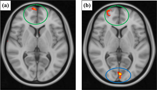 Figure 4 Refer to the image caption for details.