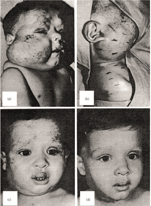 Figure 1 Refer to the image caption for details.